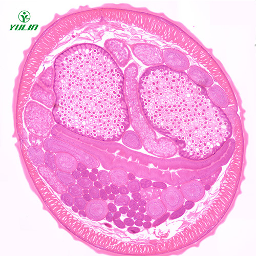 浙江蛔虫（雌）