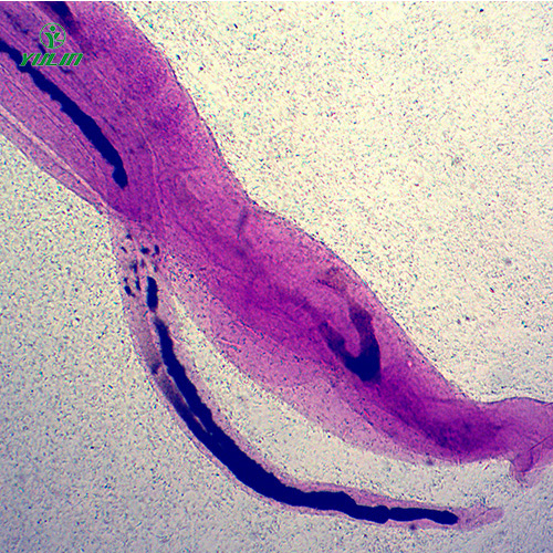 浙江日本血吸虫雌雄合抱装片