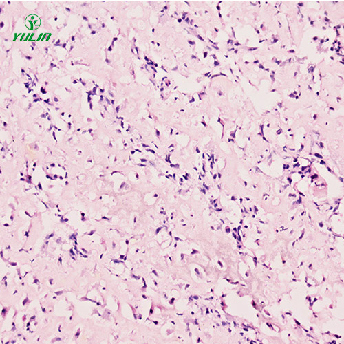 浙江人肌肉骨骼系统疾病标本片