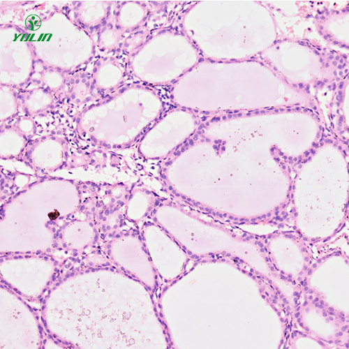 浙江人内分泌系统疾病标本片