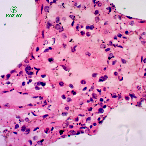 浙江人呼吸系统疾病标本片