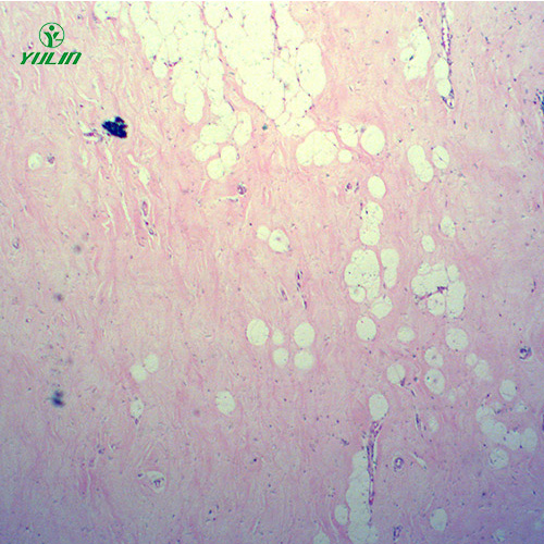 浙江人体细胞组织损伤病理切片