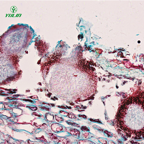 浙江水果病害标本片