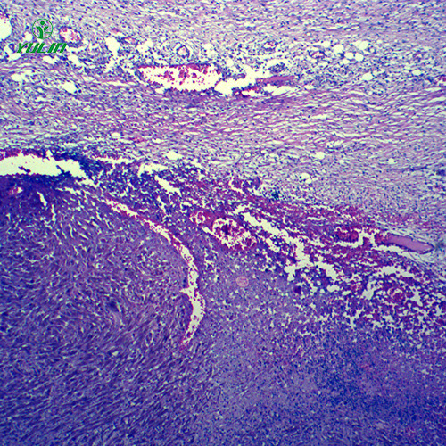 浙江动物病理学肿瘤类切片